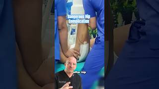 The REAL Reason Hip Replacements Dislocate⁉️