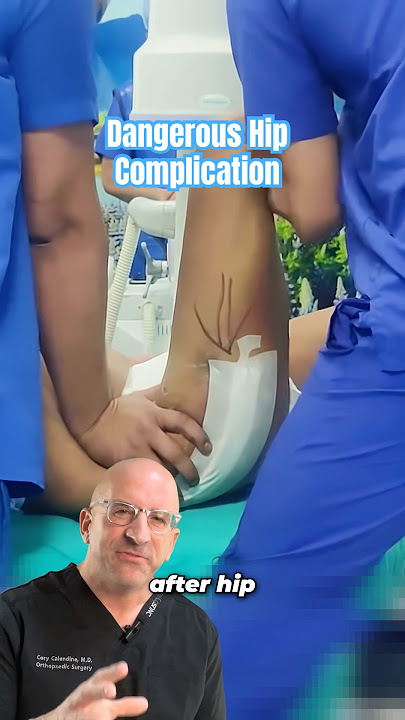 The REAL Reason Hip Replacements Dislocate⁉️