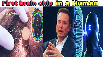 Neuralink Unveiled: The Science Behind Elon Musk