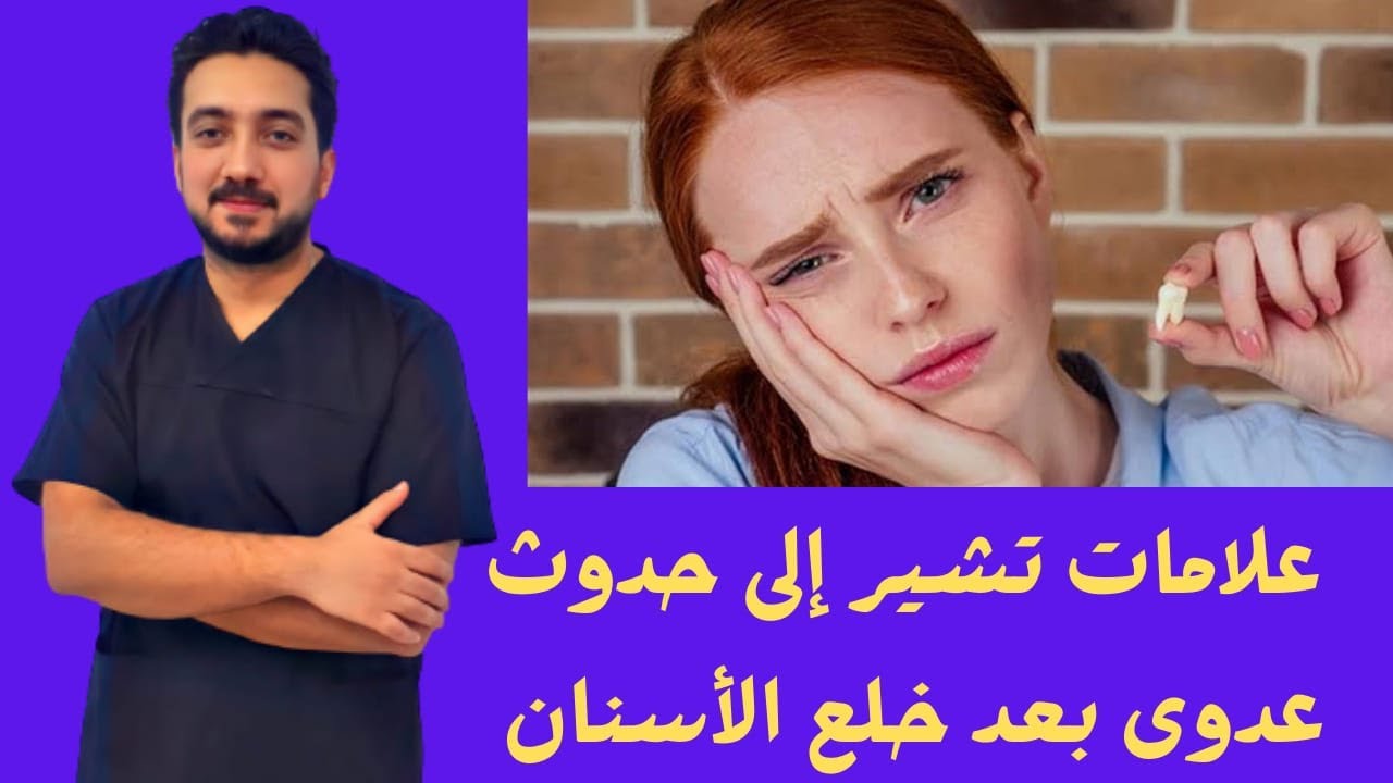 علامات تشير إلى حدوث عدوى بعد خلع الأسنان