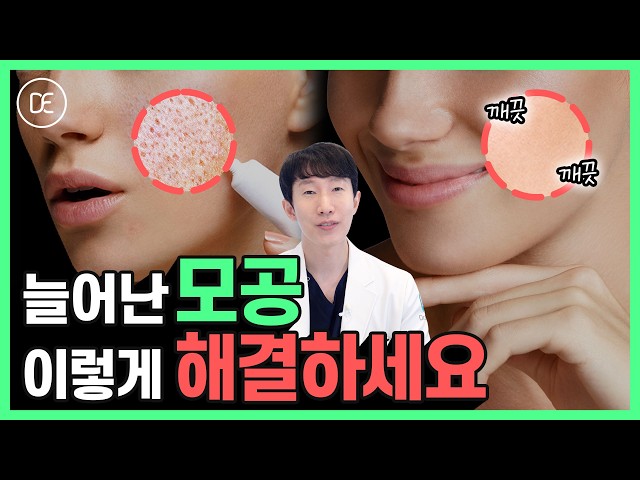 모공줄이는법 홈케어부터 시술까지 정리해 드려요 | 여드름까지 사라집니다!