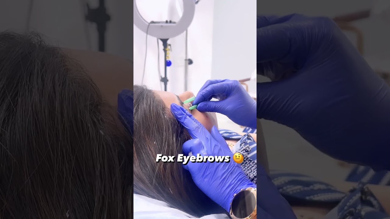 Asian Fox Eyebrow Lift for enhancing MONOLIDS | Dr. Muskan Tyagi | book your appointment  9311691081