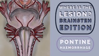 Brainstem Reflexes: Where is the lesion?