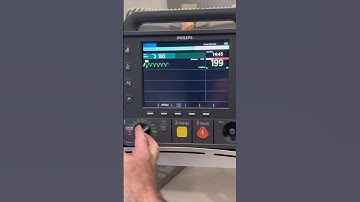 How to perform Synchronized Cardioversion using a Philips Intrepid Defibrillator