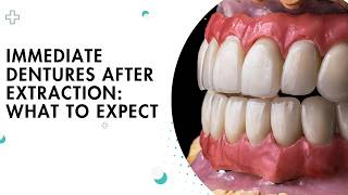 Immediate Dentures After Extraction: What to Expect | Shrouf Dental House