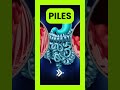 Learn to spot the key differences with our simple symptom checker. | Piles, Fissure, Fistula !