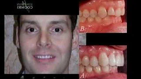 Cosmetic Dentistry by Dr Jonathan Coombs