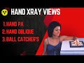 HAND X-RAY POSITION|| PA || OBLIQUE || BALL CATCHER'S|| TECHNICAL FACTORS || SID || IN HINDI || GR |