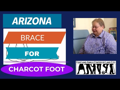 Video: Charcot Foot: Põhjused, Sümptomid Ja Ravi