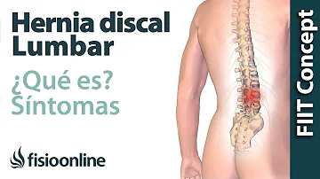 ¿Cuáles son las tres causas posibles de una hernia discal?