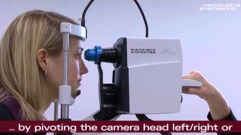 SPECTRALIS Anterior Segment Module - The perfect acquisition