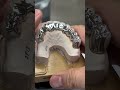 Dental Videos From around the World 8