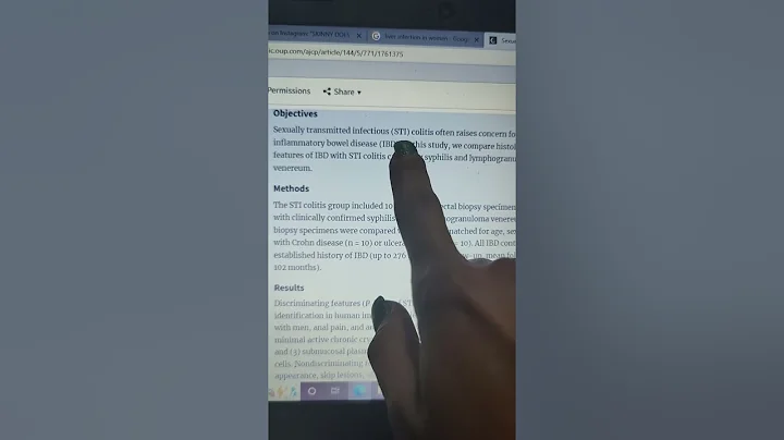 Margarita Torres most dumbest video