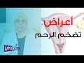 أعراض تضخم الرحم وأسبابه