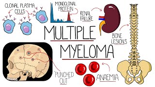Understanding Multiple Myeloma (Multiple Myeloma Explained Clearly) by Rhesus Medicine 56,629 views 11 months ago 10 minutes, 20 seconds