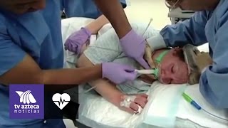 ¿Qué pasa cuando te quitan el balón intragastrico?