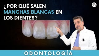 ¿Por qué salen MANCHAS BLANCAS en los dientes?🦷