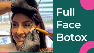 The Full Face Botox Treatment-The RJR Method