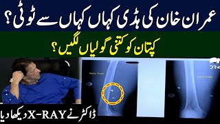 Imran Khan Knee Injury X-Ray Report | Imran Khan Medical Report | TE2P