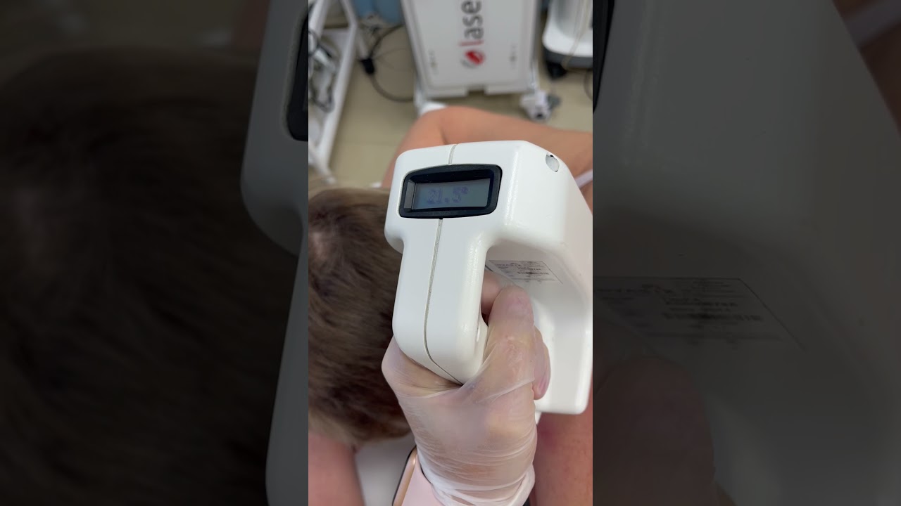 Обработка безоперационной липосакцией гобика тела Fractora Tite FX . Врач Сосина Р.А