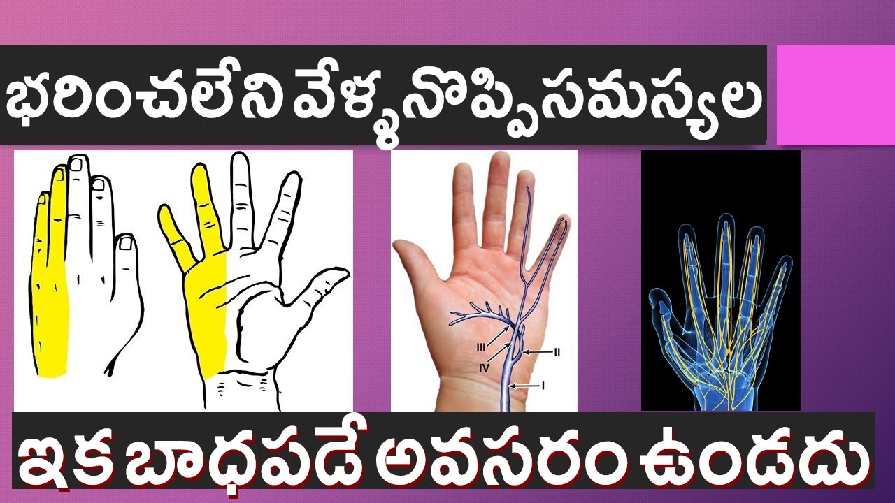 Joint Pain In Hands And Fingers During Pregnancy