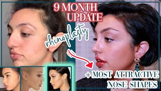 THE MOST ATTRACTIVE NOSE SHAPES + MY 9 MONTH RHINOPLASTY UPDATE (9 MONTH NOSE JOB UPDATE)