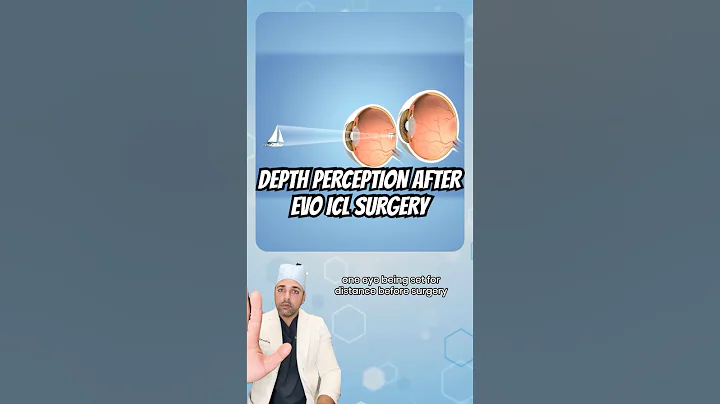 Depth perception after EVO ICL surgery