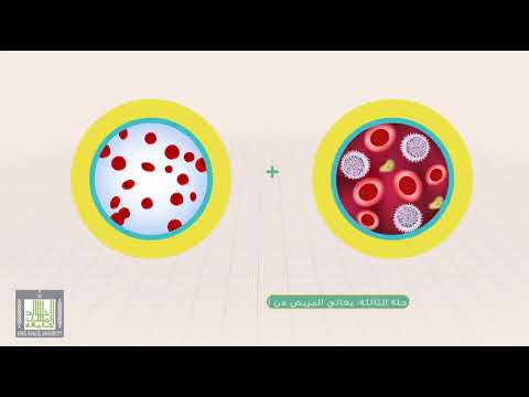 مراحل سرطان الدم الليمفاوي المزمن