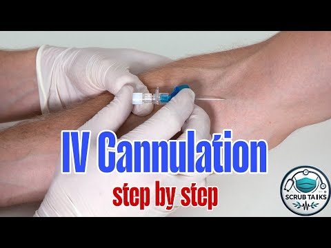 IV Cannulation Technique | Step-by-Step Guide for Nurses & Medical Student