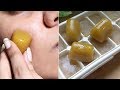 How i got Rid of Large OPEN PORES in 1 Week - Banana & Potato ice cubes for Dark Spots & Skin Repair
