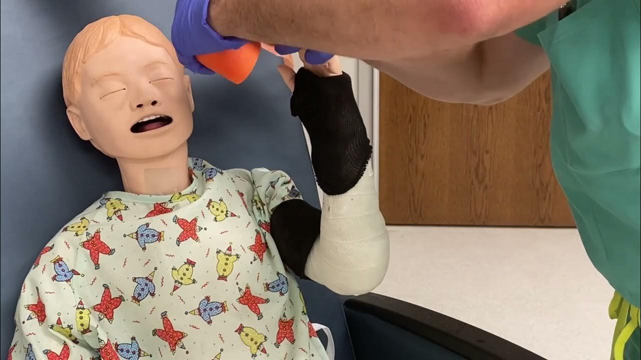 Long Arm Casts & Hanging Cast YouTube