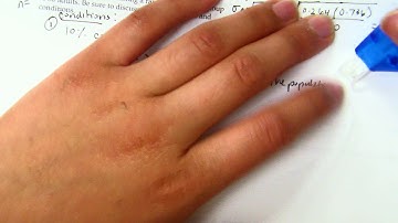 Chapter 17 Sampling Distributions for Proportions Part III