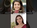 Did Kajal Aggarwal Get Plastic Surgery