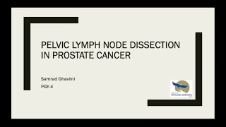 Pelvic Lymph Node Dissection in Prostate Cancer