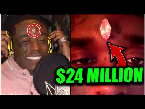 Why Lil Uzi Dropped 24 Million On A Diamond Implant On His Forehead!