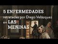 5 enfermedades retratadas por Diego Velázquez en Las Meninas