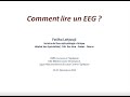 Comment lire un eeg