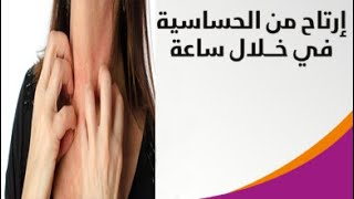 مثيرات الحساسيه وعلاجها فى المنزل