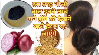 किचन की यह दो चीजो से बना शैंपू की बालों का झड़ना एक ही बार में रुक गयाNew baby hair grow huy