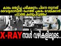 Inventory story of x ray  story of wilhelm rontgen  explained in malayalam