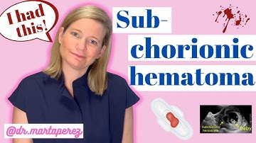 OBGYN Explains Subchorionic Hematoma | My Story First Trimester Bleeding