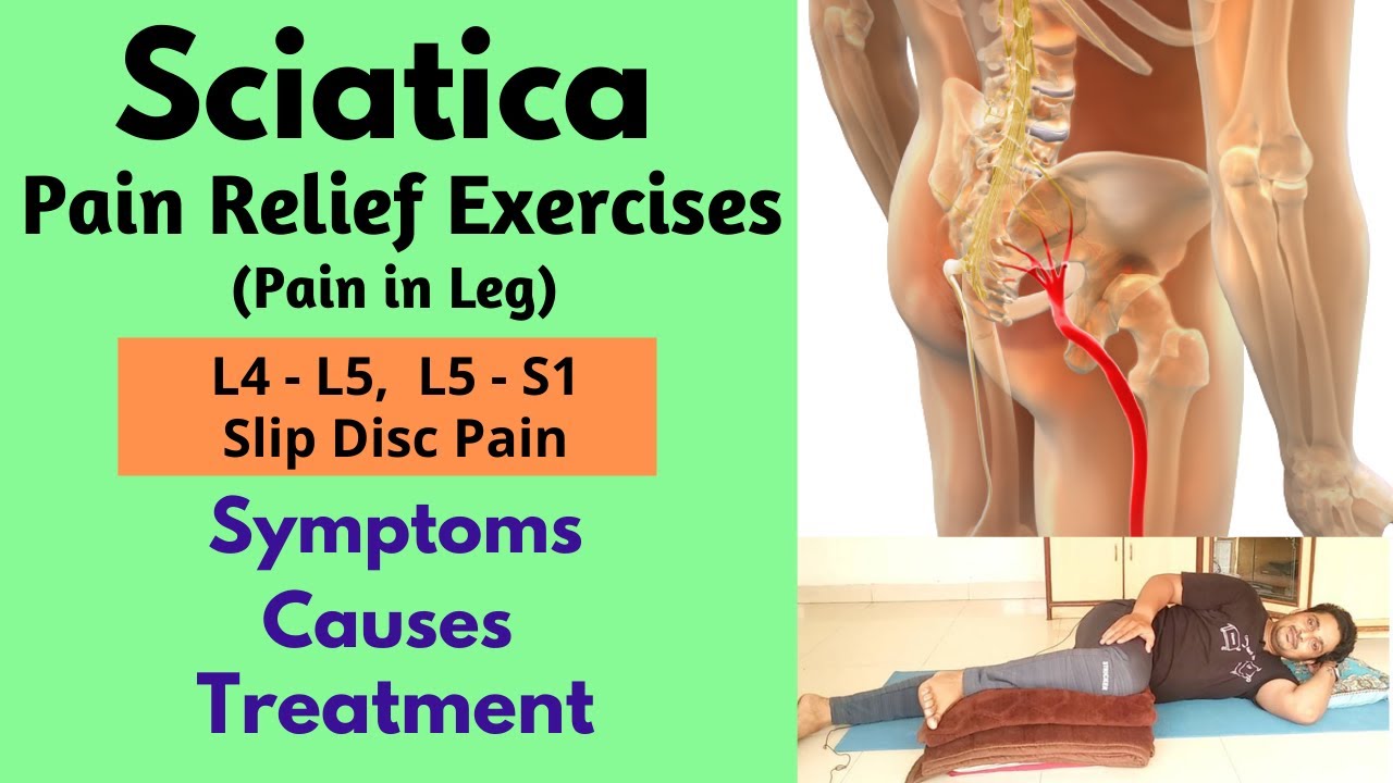 sciatica-pain-sciatica-nerve-pain-l4-l5-s1-pain-relief-exercises