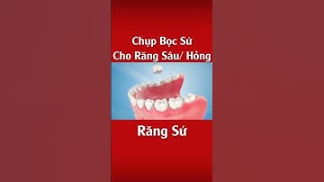 Chụp Bọc Sứ Cho Răng Sâu Hỏng | Bọc Răng Sứ