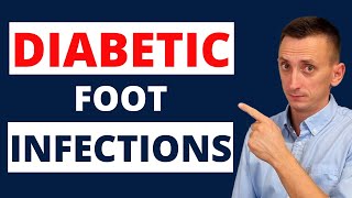 Diabetic Foot Infections: Treatment screenshot 2