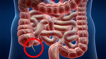 Scientists Discover The Purpose Of The Appendix