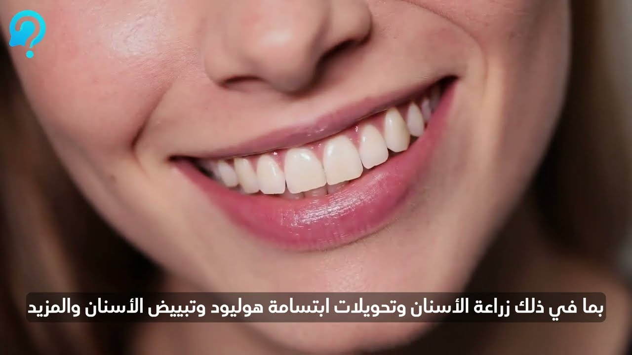 Dental Treatment, Hollywood Smile, Dental Implant, Orthodontics