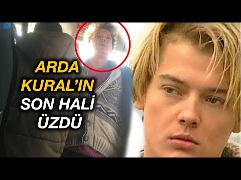 Arda Kural'ın Son Hali Üzdü