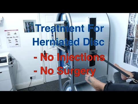 Herniated Disc Treatment, Non Surgical - a Patient's Testimonial
