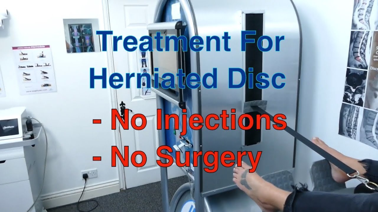 Herniated Disc Treatment, Non Surgical, a Patient's Testimonial - IDD Therapy.