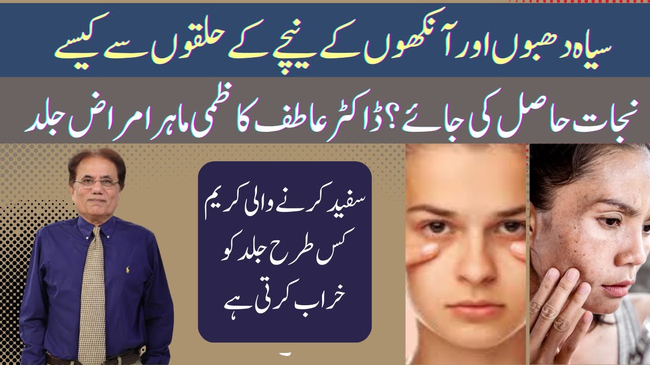 What's CAUSING Your Dark Spots and Under-Eye Circles? Dr Atif Kazmi Dermatologist